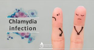 Chlamydia infection