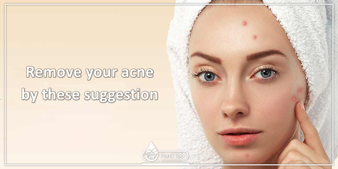 Remove your acne by these suggestion