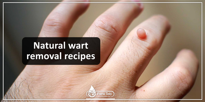 Natural wart removal recipes