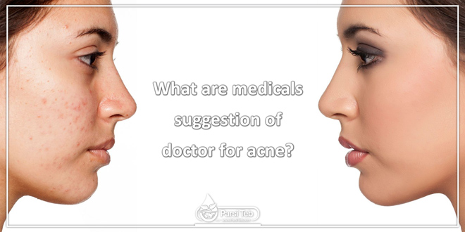 What are medicals suggestion of doctor for acne?