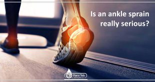 Is an ankle sprain really serious?