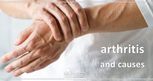 arthritis and causes