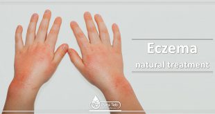 eczema natural treatment