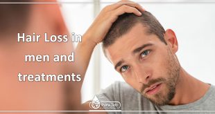 hair loss in men and treatments