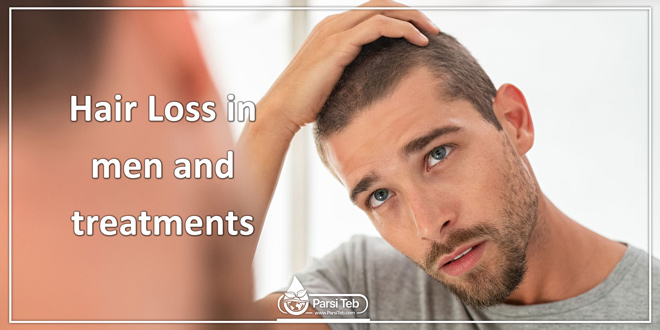 hair loss in men and treatments