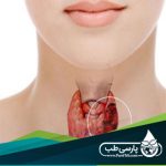 Thyroid problems