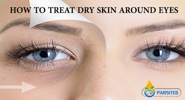 How to treat Dry Skin Around Eyes