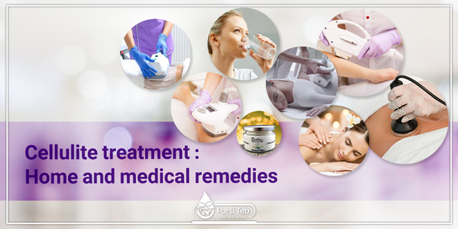 Cellulite treatment: Home and medical remedies