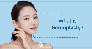 What is Genioplasty?