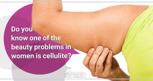 Do you know one of the beauty problems in women is cellulite?