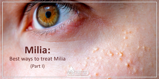 What is Milia?